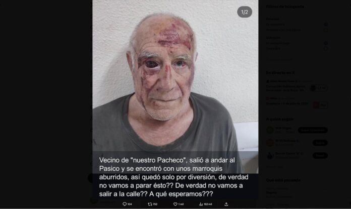 Domingo, el anciano de Torre Pacheco que fue brutalmente agredido por un grupo de jóvenes marroquíes esta semana.