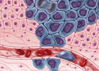 Científicos crean la vacuna que podría acabar con el cáncer de colon para siempre