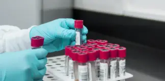 Personal sanitario con guantes azules sostiene tubos de ensayo para un análisis de sangre en el marco del programa de cribado de diabetes del Hospital Clínic.