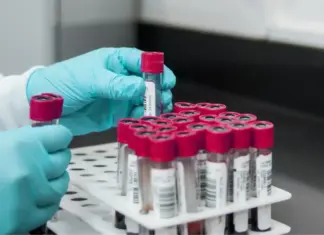 El Clínic impulsa un programa pionero de cribado de diabetes tipo 1 para familiares de pacientes Personal sanitario con guantes azules sostiene tubos de ensayo para un análisis de sangre en el marco del programa de cribado de diabetes del Hospital Clínic.